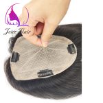 وصلات الشعر